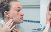 Fibromyalgia Skin Problems