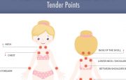 Fibromyalgia Tender Points