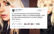 Lady Gaga Fibromyalgia
